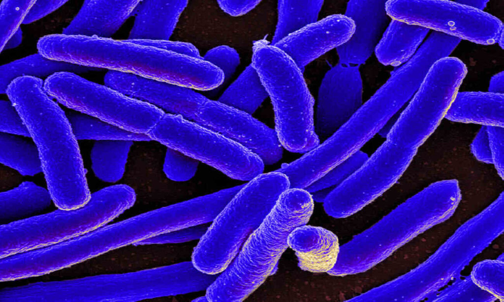 Escherichia coli al microscopio e infrarossi: foto wikimedia